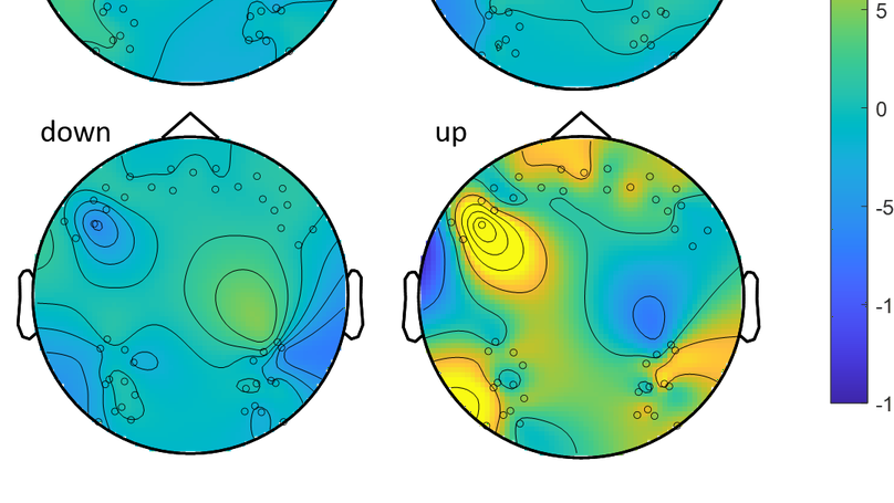 Cerebral oxygenation responses to head movement measured with near-infrared spectroscopy